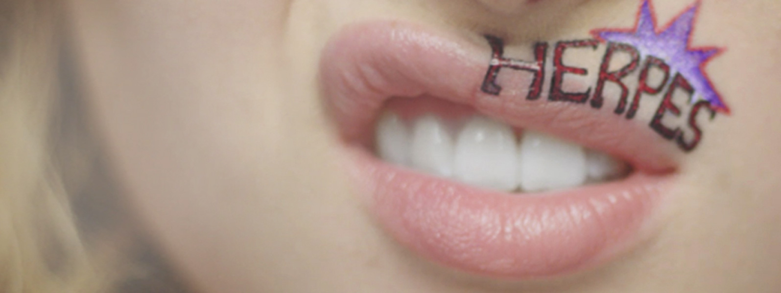 slider alovex labiale slider alovex labiale